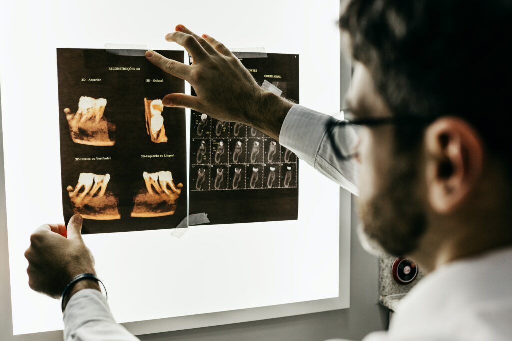 Dentist examining the x-ray of several teeth | dental care inoapps