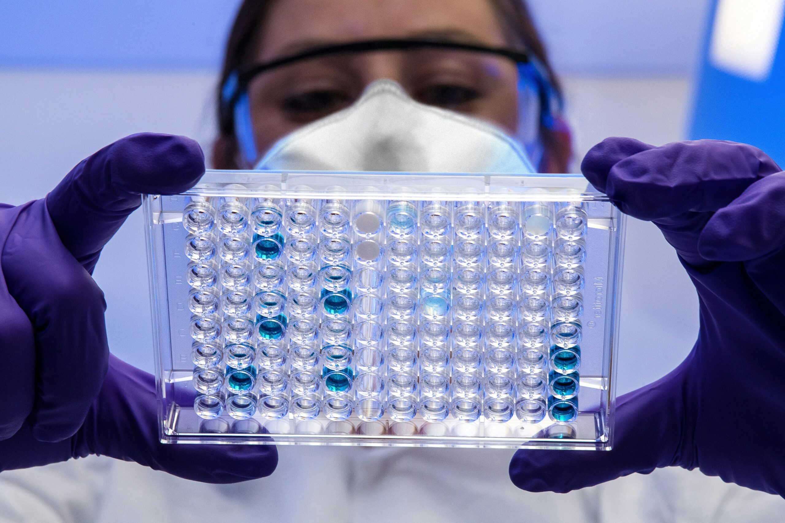 Medical researcher looks at viral testing dish | SNP SAP Novartis